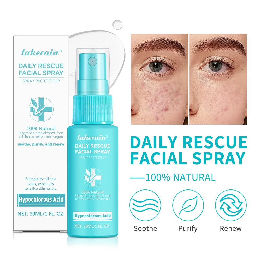 PH Balancing Toner Daily Rescue Facial Spray for Sensitive Skin Hypochlorous Acid Spray Helps Reduce Redness Breakouts Soothing